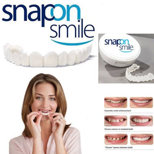 snap on smile